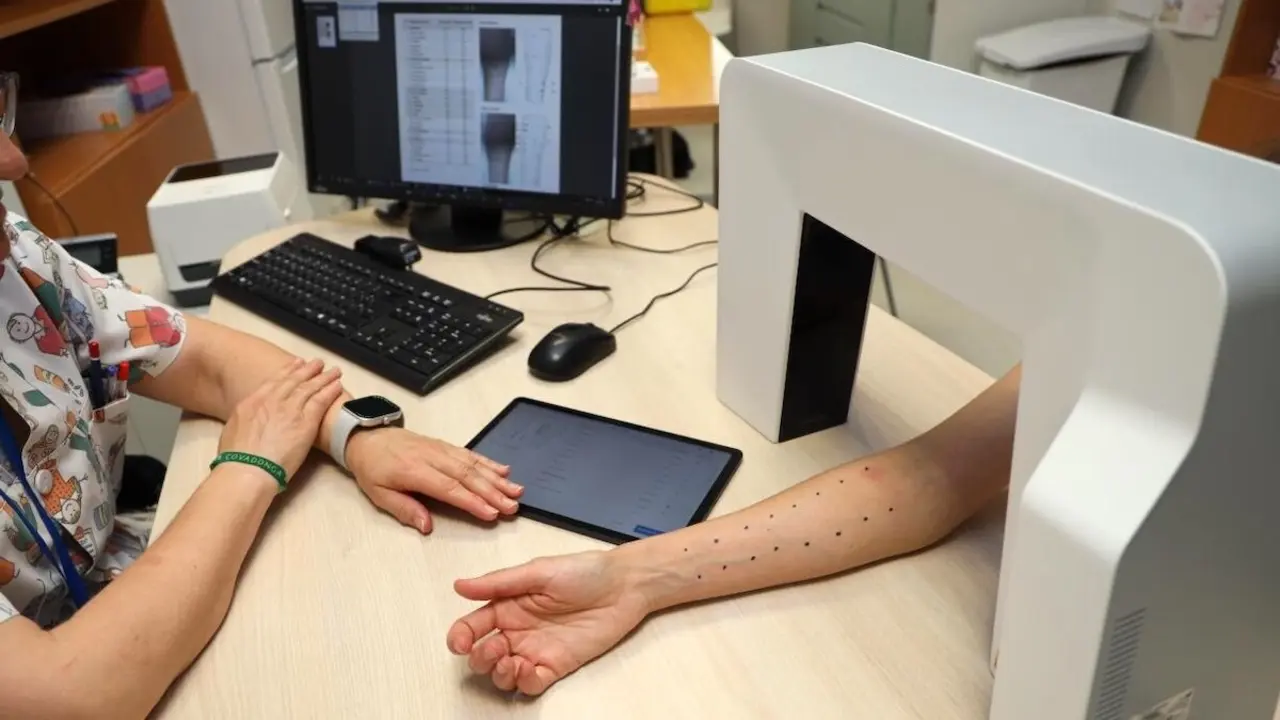 El Hospital de Toledo incorpora un método de lectura digital de pruebas cutáneas