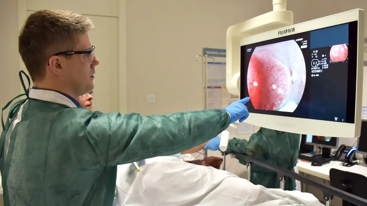 El programa de cribado de cáncer colorrectal de Castilla-La Mancha detecta 1.350 tumores malignos, colonoscopia