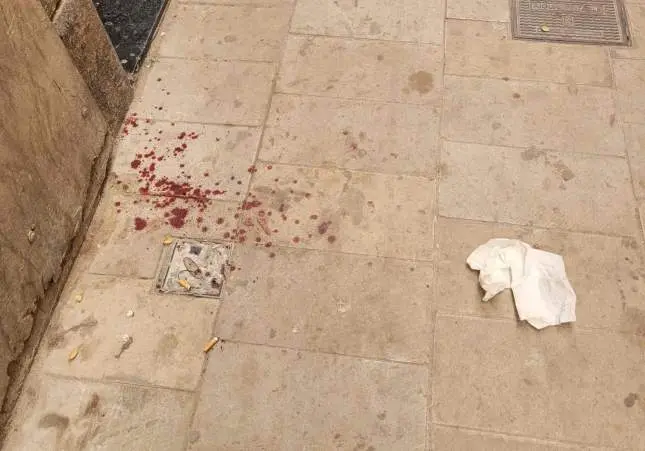 Un atraco muy violento acaba con una chica apuñalada en plena calle: está crítica