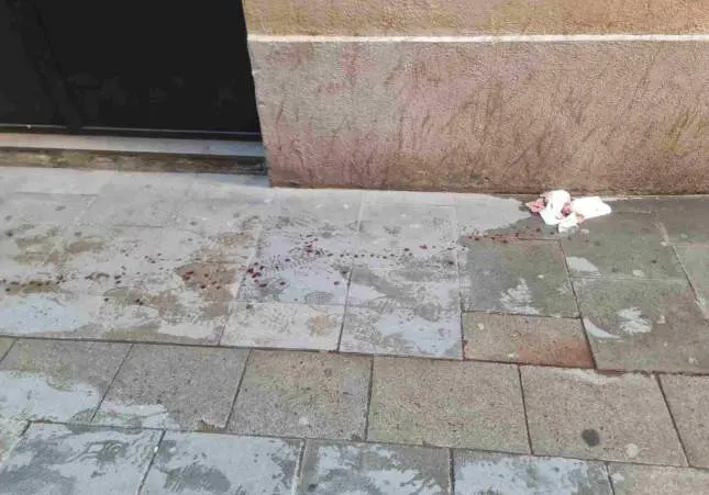 El robo de un collar deja a una mujer entre la vida y la muerte tras ser apuñalada