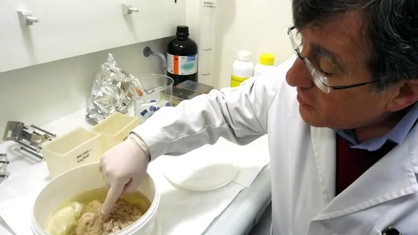 Muere el profesor Ricardo Insausti, pionero en el diagnóstico precoz del Alzhéimer