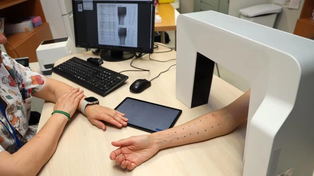 El Hospital de Toledo incorpora un método de lectura digital de pruebas cutáneas