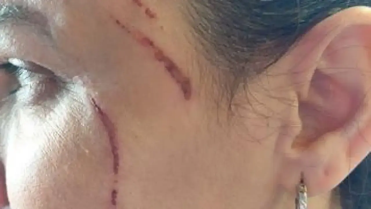 Imagen de Erica, la due&ntilde;a del local hostelero de Albacete, despu&eacute;s de haber sufrido la agresi&oacute;n por parte de varias clientas