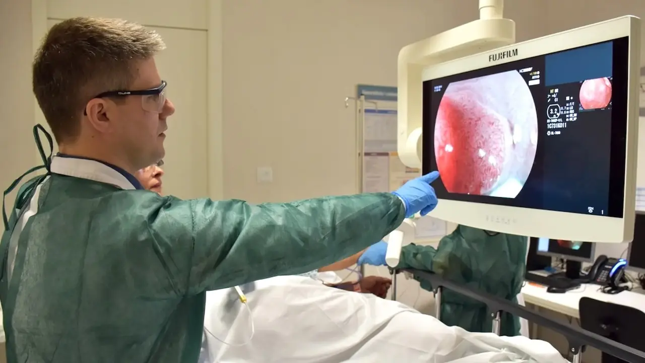 El programa de cribado de cáncer colorrectal de Castilla-La Mancha detecta 1.350 tumores malignos, colonoscopia