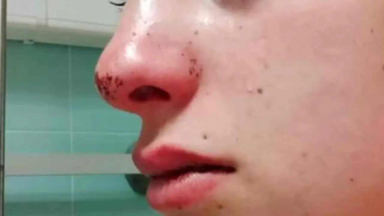 Brutal paliza a una pareja: atacados a golpes y patadas por 3 menores y sus padres