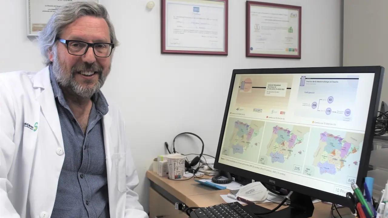 Pacientes de dermatología de Castilla-La Mancha tienen la mitad de tiempo de espera que la media