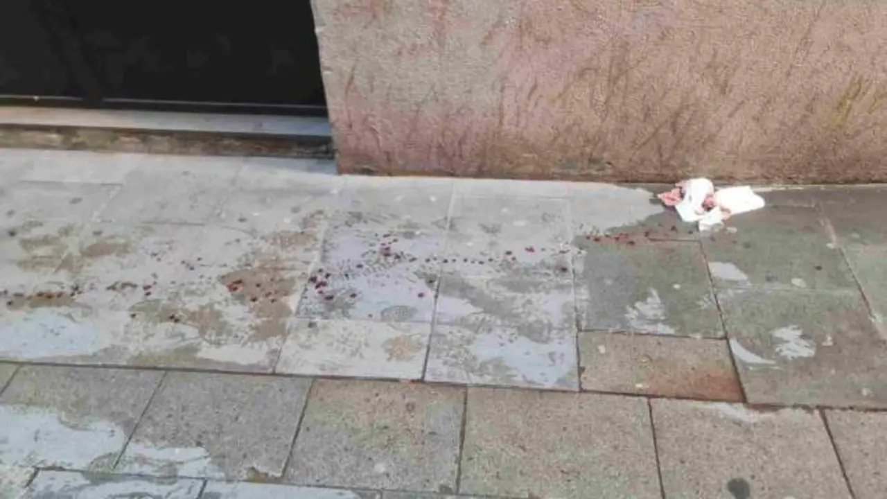 El robo de un collar deja a una mujer entre la vida y la muerte tras ser apuñalada