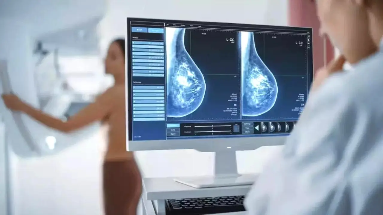 Descubren una combinación de fármacos eficaz frente al cáncer de mama más agresivo