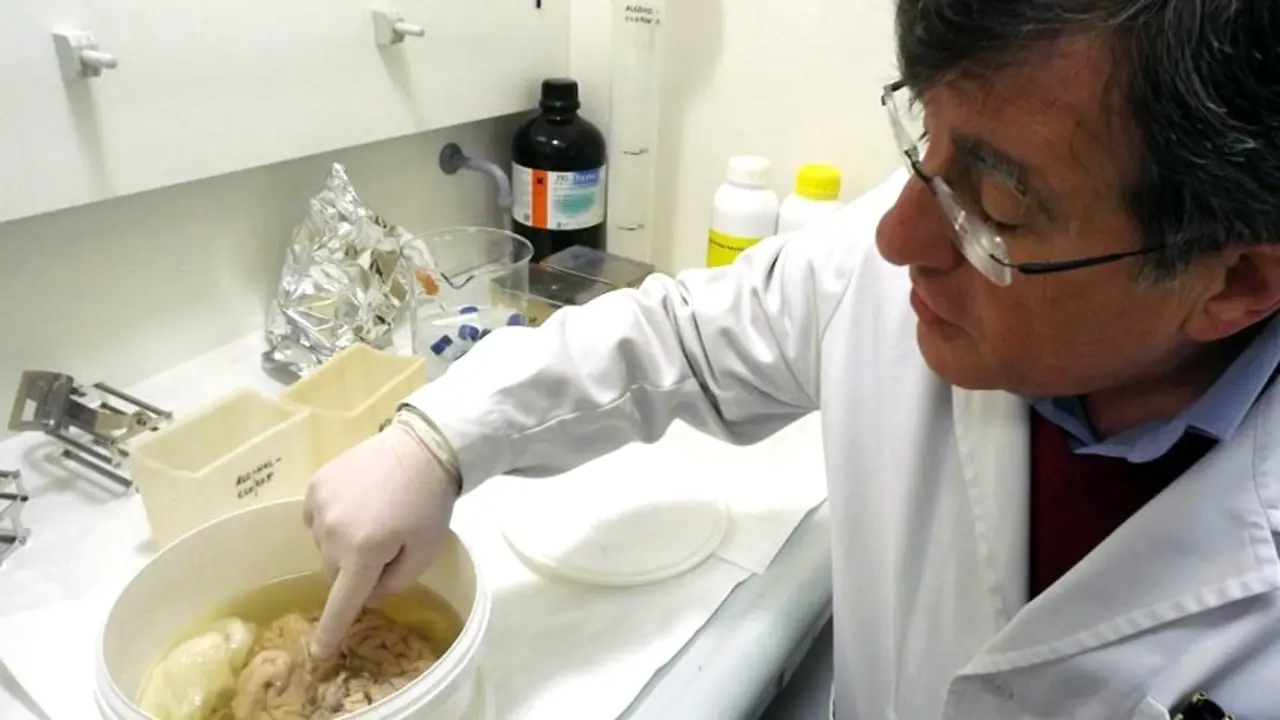 Muere el profesor Ricardo Insausti, pionero en el diagnóstico precoz del Alzhéimer