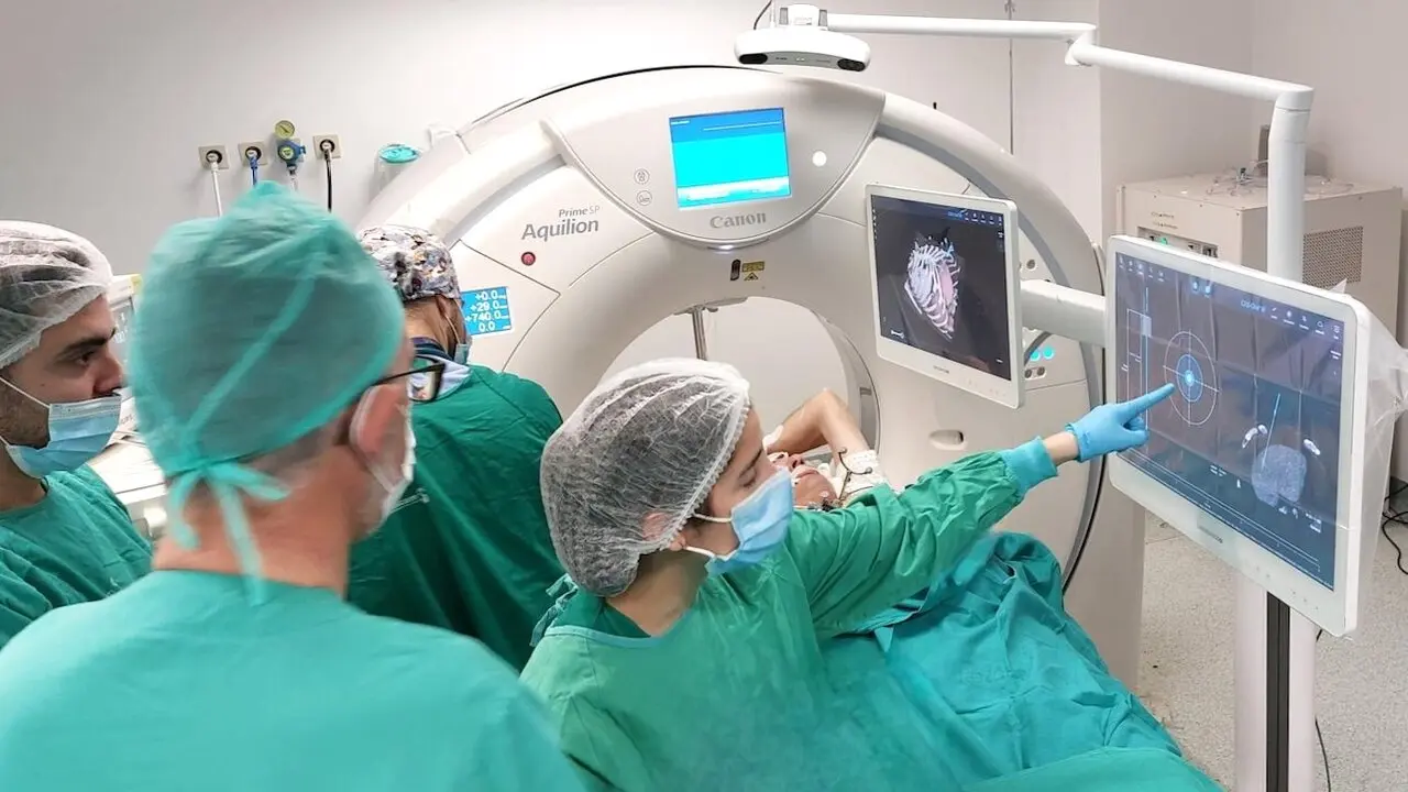 Realizan en el Hospital de Ciudad Real la primera ablación de un tumor hepático dirigida por un sistema de navegación